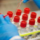 Covid-19 patient samples being prepared for testing at Northwell Health Labs in Lake Success, New York.